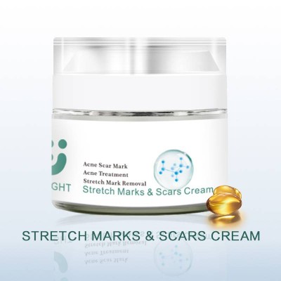 High Quality Powerful Stretch Marks Remover Skin Repair Cream Treatment Scar Removal Pregnancy Cream